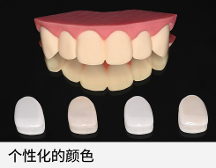 極薄強(qiáng)韌氧化鋯貼面技術(shù)，一款免磨牙貼面技術(shù)