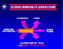 聯(lián)合麗格第 一醫(yī)院何照華院長(zhǎng)：張力帶顴骨內(nèi)推是如何固定的？
