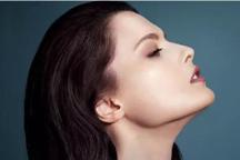 聯(lián)合麗格第 一醫(yī)院何照華院長(zhǎng)：同是下頜U型截骨，為何術(shù)后骨骼形狀卻不同？